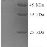 SDS-PAGE separation of QP6860 followed by commassie total protein stain results in a primary band consistent with reported data for Tyrosinase. These data demonstrate Greater than 90% as determined by SDS-PAGE.