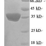 SDS-PAGE separation of QP6868 followed by commassie total protein stain results in a primary band consistent with reported data for UCP1