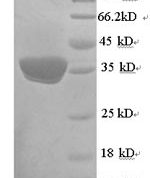 SDS-PAGE separation of QP6868 followed by commassie total protein stain results in a primary band consistent with reported data for UCP1