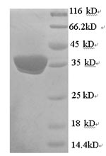 SDS-PAGE separation of QP6868 followed by commassie total protein stain results in a primary band consistent with reported data for UCP1