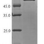 SDS-PAGE separation of QP6870 followed by commassie total protein stain results in a primary band consistent with reported data for UDP-glucuronosyltransferase 1-4. These data demonstrate Greater than 90% as determined by SDS-PAGE.