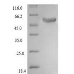 SDS-PAGE separation of QP6873 followed by commassie total protein stain results in a primary band consistent with reported data for Ubiquitin carboxyl-terminal hydrolase 14. These data demonstrate Greater than 90% as determined by SDS-PAGE.