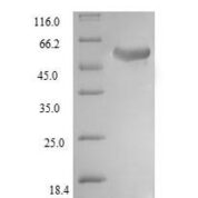 SDS-PAGE separation of QP6873 followed by commassie total protein stain results in a primary band consistent with reported data for Ubiquitin carboxyl-terminal hydrolase 14. These data demonstrate Greater than 90% as determined by SDS-PAGE.
