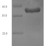 SDS-PAGE separation of QP6874 followed by commassie total protein stain results in a primary band consistent with reported data for Vesicle-associated membrane protein 2. These data demonstrate Greater than 90% as determined by SDS-PAGE.