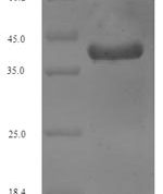SDS-PAGE separation of QP6874 followed by commassie total protein stain results in a primary band consistent with reported data for Vesicle-associated membrane protein 2. These data demonstrate Greater than 90% as determined by SDS-PAGE.