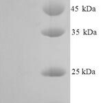 SDS-PAGE separation of QP6877 followed by commassie total protein stain results in a primary band consistent with reported data for CD106 / VCAM1. These data demonstrate Greater than 90% as determined by SDS-PAGE.