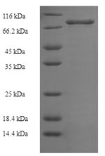 SDS-PAGE separation of QP6891 followed by commassie total protein stain results in a primary band consistent with reported data for E3 ubiquitin-protein ligase XIAP. These data demonstrate Greater than 90% as determined by SDS-PAGE.