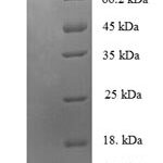 SDS-PAGE separation of QP6904 followed by commassie total protein stain results in a primary band consistent with reported data for Zinc finger protein 175. These data demonstrate Greater than 90% as determined by SDS-PAGE.