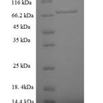 SDS-PAGE separation of QP6905 followed by commassie total protein stain results in a primary band consistent with reported data for Zinc finger protein 212. These data demonstrate Greater than 90% as determined by SDS-PAGE.