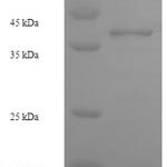 SDS-PAGE separation of QP6909 followed by commassie total protein stain results in a primary band consistent with reported data for Zinc finger protein 581. These data demonstrate Greater than 90% as determined by SDS-PAGE.