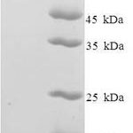 SDS-PAGE separation of QP6913 followed by commassie total protein stain results in a primary band consistent with reported data for ZSCAN20. These data demonstrate Greater than 90% as determined by SDS-PAGE.