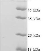 SDS-PAGE separation of QP6913 followed by commassie total protein stain results in a primary band consistent with reported data for ZSCAN20. These data demonstrate Greater than 90% as determined by SDS-PAGE.