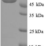 SDS-PAGE separation of QP6914 followed by commassie total protein stain results in a primary band consistent with reported data for Creatinine amidohydrolase. These data demonstrate Greater than 90% as determined by SDS-PAGE.