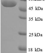 SDS-PAGE separation of QP6914 followed by commassie total protein stain results in a primary band consistent with reported data for Creatinine amidohydrolase. These data demonstrate Greater than 90% as determined by SDS-PAGE.