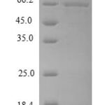 SDS-PAGE separation of QP6933 followed by commassie total protein stain results in a primary band consistent with reported data for MMP13 Protein. These data demonstrate Greater than 90% as determined by SDS-PAGE.