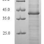 SDS-PAGE separation of QP6943 followed by commassie total protein stain results in a primary band consistent with reported data for cagA. These data demonstrate Greater than 80% as determined by SDS-PAGE.