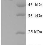 SDS-PAGE separation of QP6947 followed by commassie total protein stain results in a primary band consistent with reported data for Glutamate decarboxylase alpha. These data demonstrate Greater than 90% as determined by SDS-PAGE.