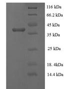 SDS-PAGE separation of QP6952 followed by commassie total protein stain results in a primary band consistent with reported data for Phosphoprotein. These data demonstrate Greater than 90% as determined by SDS-PAGE.
