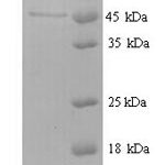 SDS-PAGE separation of QP6953 followed by commassie total protein stain results in a primary band consistent with reported data for nrdB. These data demonstrate Greater than 90% as determined by SDS-PAGE.