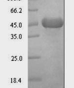SDS-PAGE separation of QP6965 followed by commassie total protein stain results in a primary band consistent with reported data for Lipid kinase YegS. These data demonstrate Greater than 90% as determined by SDS-PAGE.