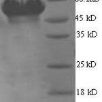 SDS-PAGE separation of QP6981 followed by commassie total protein stain results in a primary band consistent with reported data for Glutamate--tRNA ligase 1. These data demonstrate Greater than 90% as determined by SDS-PAGE.