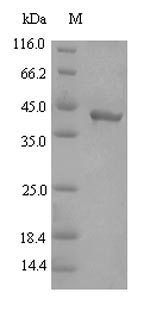SDS-PAGE separation of QP6989 followed by commassie total protein stain results in a primary band consistent with reported data for Gingipain R2. These data demonstrate Greater than 90% as determined by SDS-PAGE.