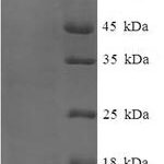 SDS-PAGE separation of QP6995 followed by commassie total protein stain results in a primary band consistent with reported data for PA-I galactophilic lectin. These data demonstrate Greater than 90% as determined by SDS-PAGE.