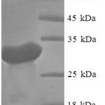 SDS-PAGE separation of QP6996 followed by commassie total protein stain results in a primary band consistent with reported data for Hepatitis C virus genotype 1a (isolate 1) polyprotein. These data demonstrate Greater than 90% as determined by SDS-PAGE.