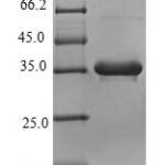 SDS-PAGE separation of QP6998 followed by commassie total protein stain results in a primary band consistent with reported data for Complement C4-B. These data demonstrate Greater than 90% as determined by SDS-PAGE.