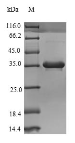 SDS-PAGE separation of QP6998 followed by commassie total protein stain results in a primary band consistent with reported data for Complement C4-B. These data demonstrate Greater than 90% as determined by SDS-PAGE.