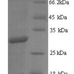 SDS-PAGE separation of QP7004 followed by commassie total protein stain results in a primary band consistent with reported data for Ag85B. These data demonstrate Greater than 90% as determined by SDS-PAGE.