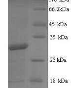 SDS-PAGE separation of QP7004 followed by commassie total protein stain results in a primary band consistent with reported data for Ag85B. These data demonstrate Greater than 90% as determined by SDS-PAGE.