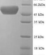 SDS-PAGE separation of QP7007 followed by commassie total protein stain results in a primary band consistent with reported data for Periplasmic serine endoprotease DegP. These data demonstrate Greater than 90% as determined by SDS-PAGE.