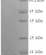 SDS-PAGE separation of QP7016 followed by commassie total protein stain results in a primary band consistent with reported data for Heat-labile enterotoxin B chain. These data demonstrate Greater than 90% as determined by SDS-PAGE.