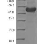 SDS-PAGE separation of QP7020 followed by commassie total protein stain results in a primary band consistent with reported data for Ovoinhibitor. These data demonstrate Greater than 90% as determined by SDS-PAGE.