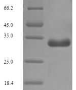 SDS-PAGE separation of QP7022 followed by commassie total protein stain results in a primary band consistent with reported data for F17 fimbrial protein. These data demonstrate Greater than 90% as determined by SDS-PAGE.