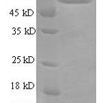 SDS-PAGE separation of QP7035 followed by commassie total protein stain results in a primary band consistent with reported data for RBMY1A1. These data demonstrate Greater than 90% as determined by SDS-PAGE.