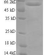 SDS-PAGE separation of QP7035 followed by commassie total protein stain results in a primary band consistent with reported data for RBMY1A1. These data demonstrate Greater than 90% as determined by SDS-PAGE.