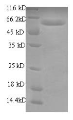 SDS-PAGE separation of QP7035 followed by commassie total protein stain results in a primary band consistent with reported data for RBMY1A1. These data demonstrate Greater than 90% as determined by SDS-PAGE.