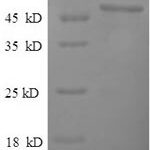 SDS-PAGE separation of QP7045 followed by commassie total protein stain results in a primary band consistent with reported data for Pyruvate carboxylase 1. These data demonstrate Greater than 90% as determined by SDS-PAGE.