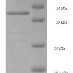 SDS-PAGE separation of QP7046 followed by commassie total protein stain results in a primary band consistent with reported data for Enterotoxin type E. These data demonstrate Greater than 90% as determined by SDS-PAGE.