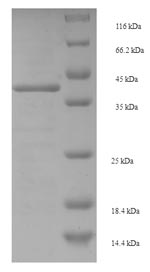 SDS-PAGE separation of QP7046 followed by commassie total protein stain results in a primary band consistent with reported data for Enterotoxin type E. These data demonstrate Greater than 90% as determined by SDS-PAGE.