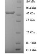 SDS-PAGE separation of QP7048 followed by commassie total protein stain results in a primary band consistent with reported data for HLA-E. These data demonstrate Greater than 90% as determined by SDS-PAGE.
