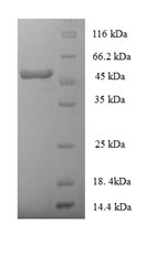 SDS-PAGE separation of QP7048 followed by commassie total protein stain results in a primary band consistent with reported data for HLA-E. These data demonstrate Greater than 90% as determined by SDS-PAGE.
