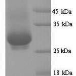 SDS-PAGE separation of QP7052 followed by commassie total protein stain results in a primary band consistent with reported data for Rotavirus A Outer capsid protein VP4. These data demonstrate Greater than 90% as determined by SDS-PAGE.