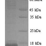 SDS-PAGE separation of QP7058 followed by commassie total protein stain results in a primary band consistent with reported data for PLA2G2A. These data demonstrate Greater than 90% as determined by SDS-PAGE.