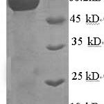 SDS-PAGE separation of QP7060 followed by commassie total protein stain results in a primary band consistent with reported data for Nucleoprotein. These data demonstrate Greater than 90% as determined by SDS-PAGE.