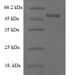 SDS-PAGE separation of QP7063 followed by commassie total protein stain results in a primary band consistent with reported data for Intermediate capsid protein VP6. These data demonstrate Greater than 90% as determined by SDS-PAGE.