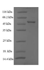 SDS-PAGE separation of QP7063 followed by commassie total protein stain results in a primary band consistent with reported data for Intermediate capsid protein VP6. These data demonstrate Greater than 90% as determined by SDS-PAGE.