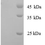 SDS-PAGE separation of QP7075 followed by commassie total protein stain results in a primary band consistent with reported data for DNA ligase. These data demonstrate Greater than 90% as determined by SDS-PAGE.